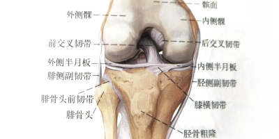 膝关节运动损伤导致内侧副韧带撕裂是怎么回事？