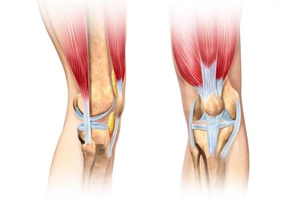 半月板与髌骨软化区别