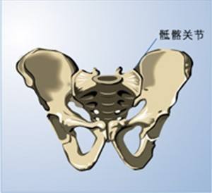 骶髂关节炎